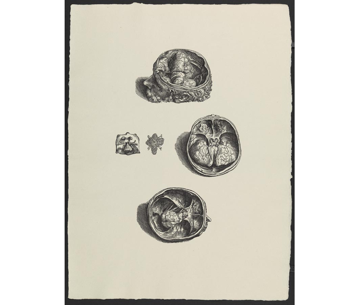 Intricate drawing of three men's heads sliced horizontally open; view from above. They look vaguely like cracked walnuts.